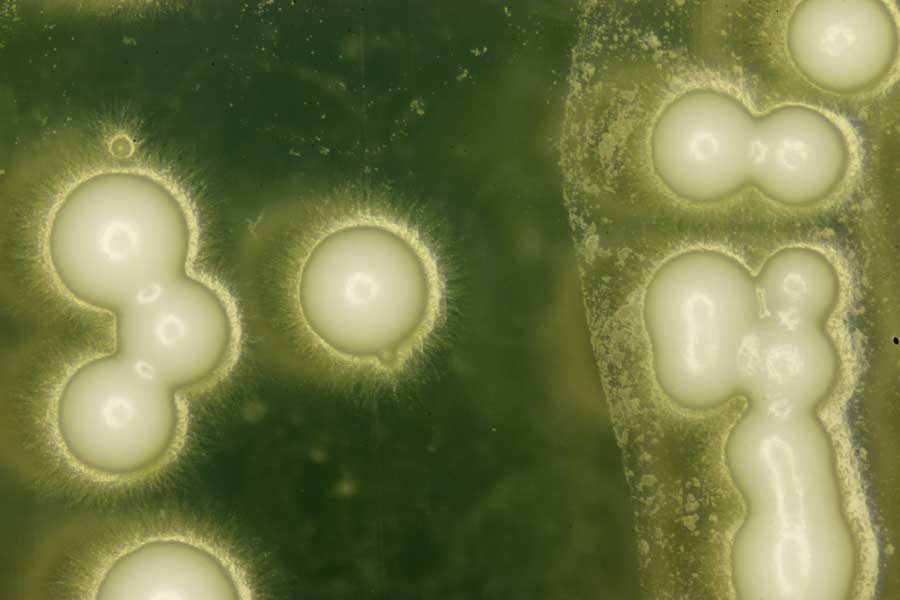 yeast under a microscope